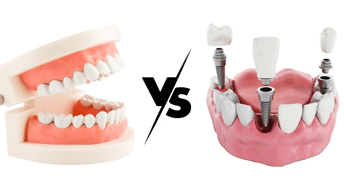 Съёмные протезы vs. несъёмные: плюсы, минусы и кому подойдёт